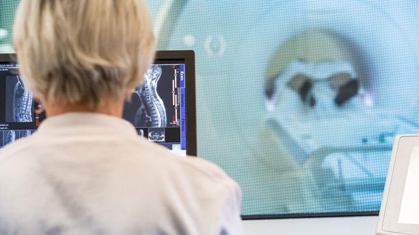 Hovedstaden i ny aftale med IBM: Nu skal kunstig intelligens ind i sundhedssektoren